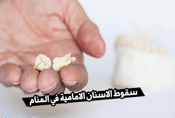 سقوط الاسنان الامامية في المنام