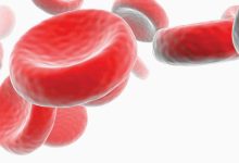 6 علامات لأعراض فقر الدم الشائعة