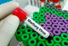 ما هو فيروس ماربورغ أسباب الإصابة والأعراض وطرق العلاج