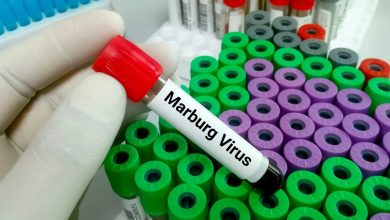 ما هو فيروس ماربورغ أسباب الإصابة والأعراض وطرق العلاج